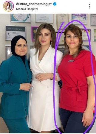 Kosmetoloq Nuridə Əhmədova pasiyenti bu hala salıb?
