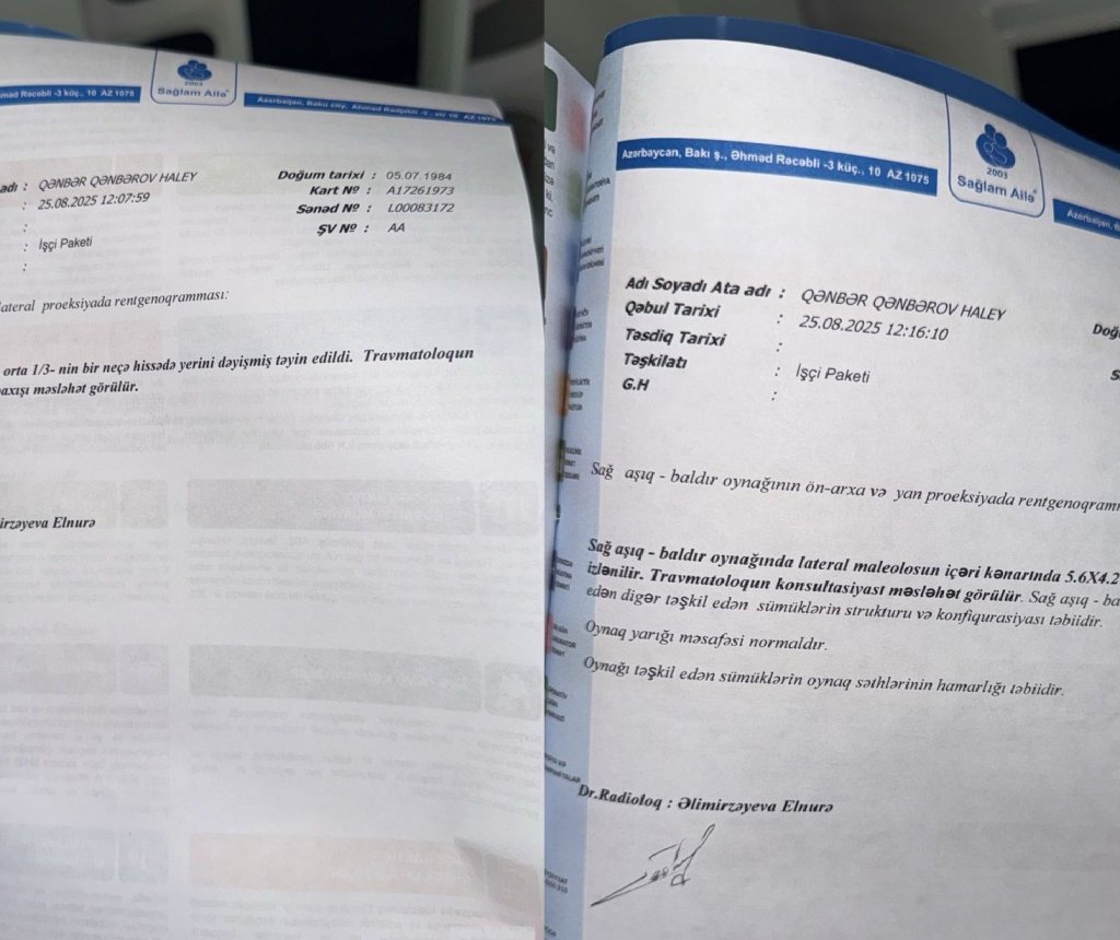 “Nane Pub” insident: Mehman Əzizov restoranda oğlumun doğum günündə məni döydü….