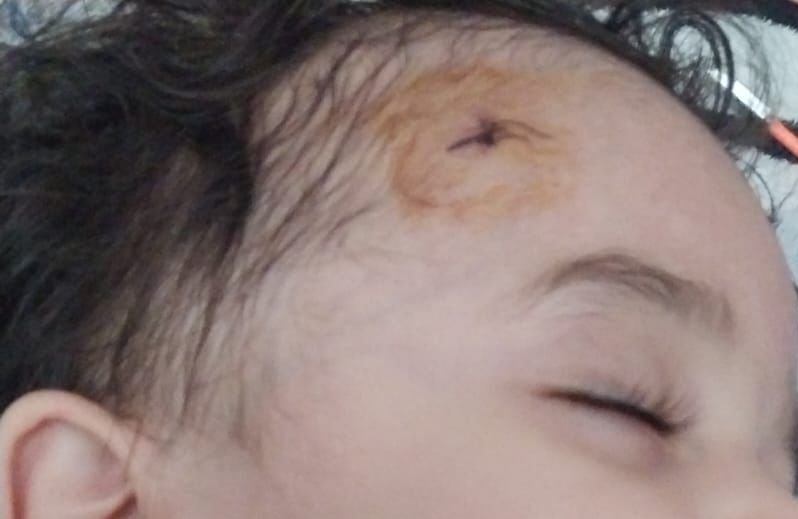 “Etimad KİDS” bağçasında uşağın başı yarıldı, ailəsinə xəbər verilmədi