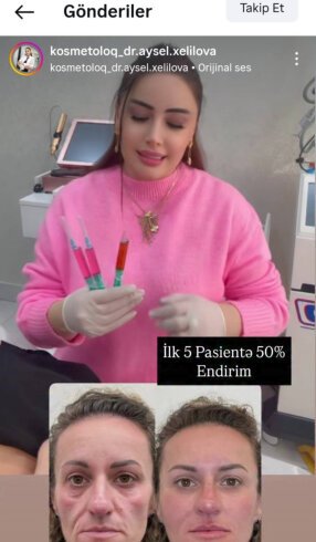 “Doktor” adı altında təhlükəli fəaliyyət - Aysel Xəlilovanın tibbi təhsili varmı?