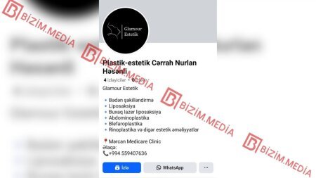 Plastik cərrah kimi fəliyyətinə rəsmən icazə verilməyən Nurlan Həsənli yenidən İŞ BAŞINDA – FOTOFAKT
