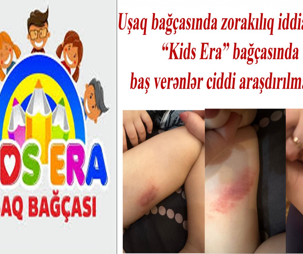 “Kids Era” bağçasında zorakılıq iddiaları - TƏFƏRRÜAT